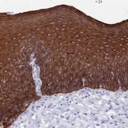 MTMR2 Antibody, Novus Biologicals:Antibodies:Primary Antibodies
